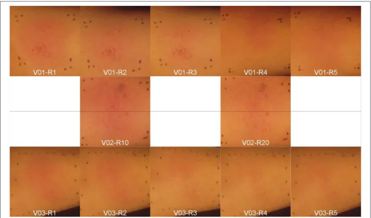 FIGURE 3 | Artificially induced skin erythema on three volunteers’ (V01-V03) forearms