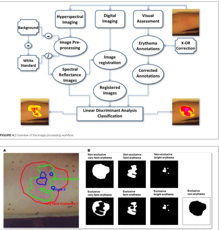 FIGURE 4 | Overview of the image processing workflow.