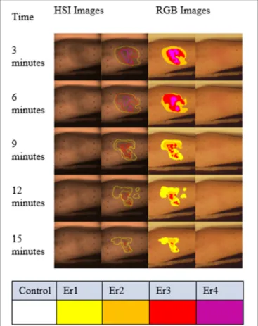 FIGURE 7 | Graded regions of different erythema levels overlaid with color (right two columns) and spectral images (gray scale images in the left two columns) from one volunteer