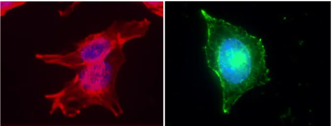 Fig. 1: The organization of actin (left) and microtubules (right) of Hep G2 shown by  fluorescent microscopy 