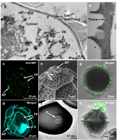 Figure 2. Subcellular localization of LpMIF. (a,b) TEM of immunogold-labeled L. polyedra cells  showing the accumulation of gold particles (black dots) in membranes of the vesicular bodies (VB)  and in the theca