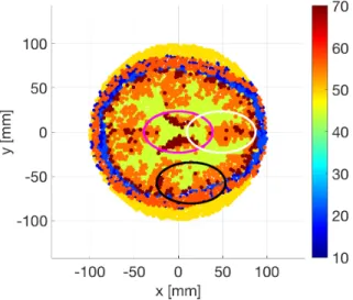 Fig. 2. Real part of the complex permittivity ✏ r of the brain (cross-section) according to the model derived from MRI and CT-scan, including the three stroke locations (stroke A, stroke B and stroke C in magenta, white and black curves respectively).