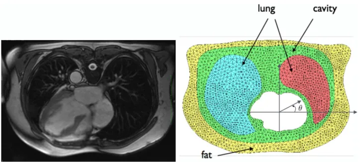 Figure 2. MRI 2D slice of the torso (left), 2D computational mesh of the torso geometry showing the different regions of the torso considered in this study: fat, lungs and torso cavity (right)
