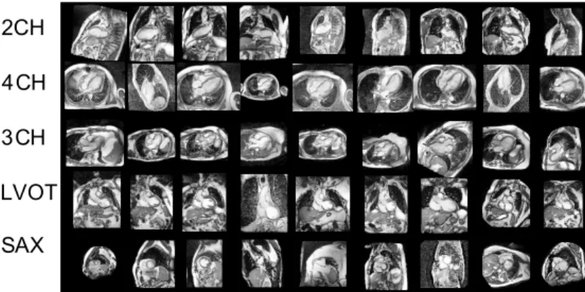 Figure 8. Typical examples of the training images from the DETERMINE data-set for different views