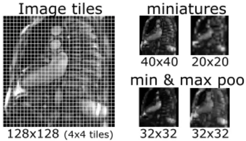 Figure 5. Image miniatures by min- and max-pooling local intensities (Margeta,  Cri-minisi, et al