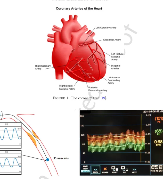 Figure 1. The coronary tree [19].