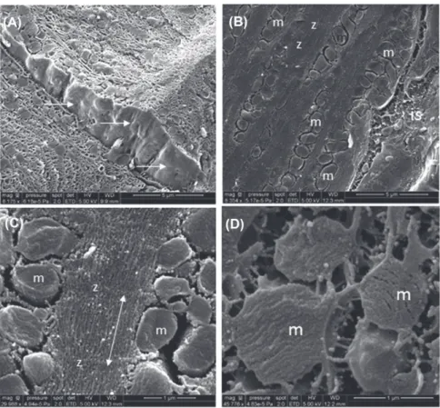 Fig. 8. SEM examination fractured of ultrastructure mice myocardium. (A) At low magnification, cardiomyocytes can be examined in the myocardium with a 3D view (sarcolemma is apparent: arrow)