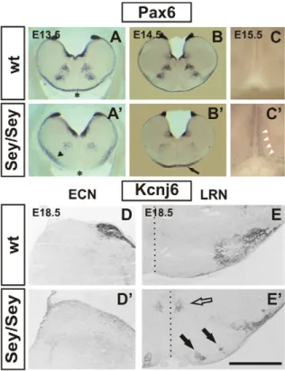 Figure 2. Migration defects of Pax6 Sey/Sey pre-cerebellar neu- neu-rons: histology. Coronal vibratome Pax6 in situ hybridizations of wt (A - C) and mutant (A9–C9) embryos