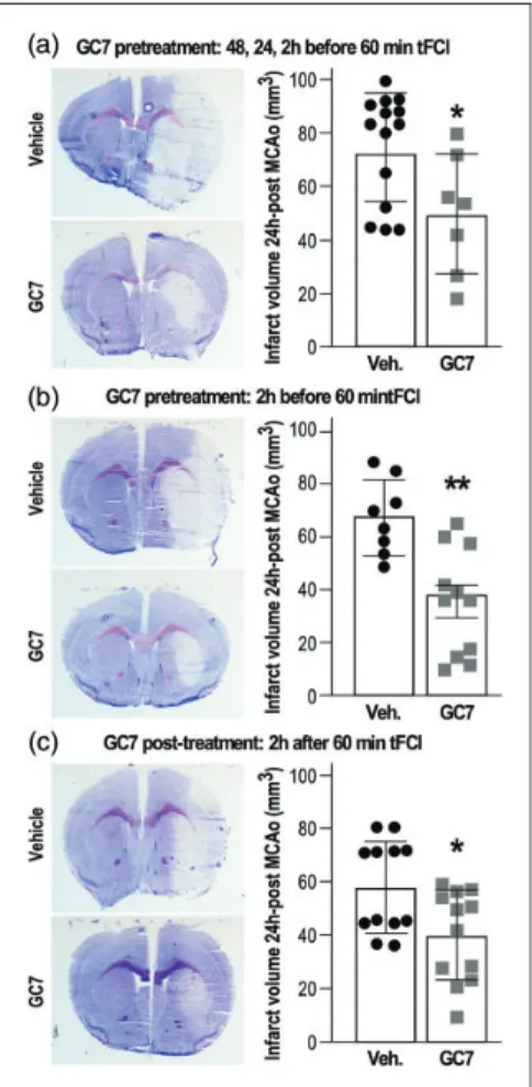Figure 3. GC7 intraperitoneal injection reduces tFCI-induced infarct volume. (a) Three injections of GC7 (3 mg/kg daily for three days) or (b) a single injection 2 h before tFCI or (c) a single post-treatment 2 h after tFCI significantly reduce tFCI-induce