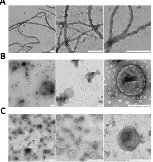 Figure 3. Electron micrographs of negatively stained (A) recombinant full-length Sup35p fibrils as- as-sembled in vitro, (B) extracellular vesicles (EV) purified from yeast culture medium and (C)  periplas-mic vesicles (PV) extracted from the yeast peripla