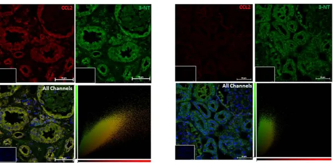 Figure 1.  Protein nitration in ischaemia–reperfusion injury. Kidney sections from patients diagnosed  with ATN as a result of ischaemia-reperfusion injury sustained during kidney transplant were stained by  immunofluorescence for 3-nitrotyrosine and CCL2