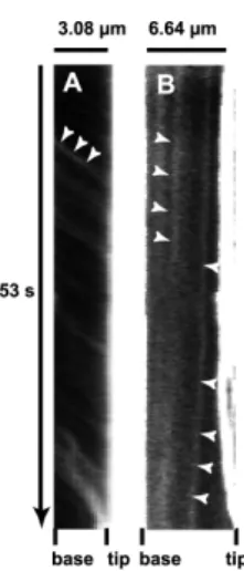 FIG.  4.  Kymographs  illustrating  the  forward  and  backward  movements  of  GFP-MyoX