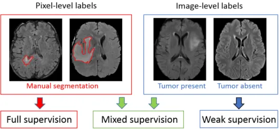 Figure 1: Different levels of supervision for training of segmentation models. Stan- Stan-dard models are trained on fully-annotated images only, with pixel-level labels