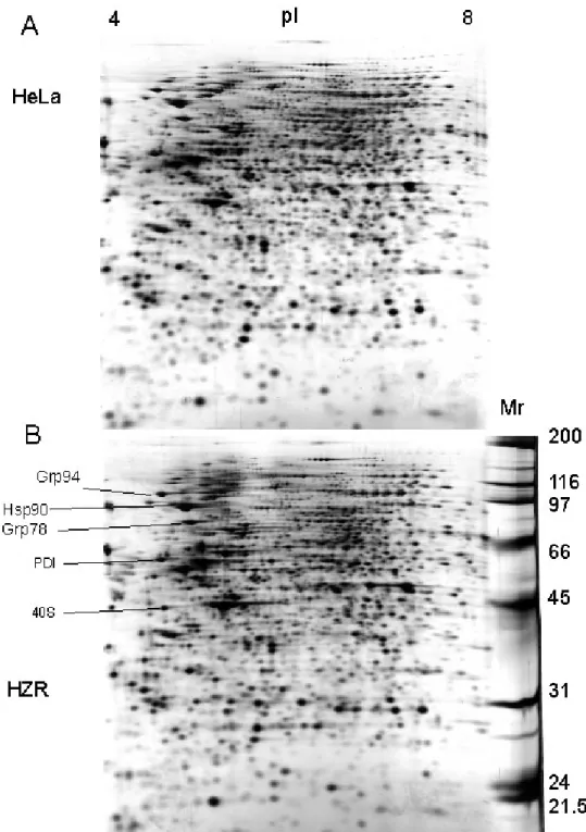 Figure 1. 2-DE of total cell extracts from HeLa (A) and HZR (B) cells. Two hundred  micrograms of proteins were separated on pH 4-8 linear immobilized pH gradients (horizontal  axis) and 10% continuous SDS gels (vertical axis)