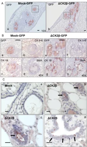 Figure 4. IHC analysis of ΔCK2β- and Mock-MCF10A cells injected in inguinal mammary fate pad