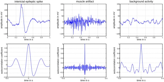 Fig. 1. Example of an interictal epileptic spike (left), a muscle artifact (middle), and background activity of the brain (right) and their autocorrelation functions.