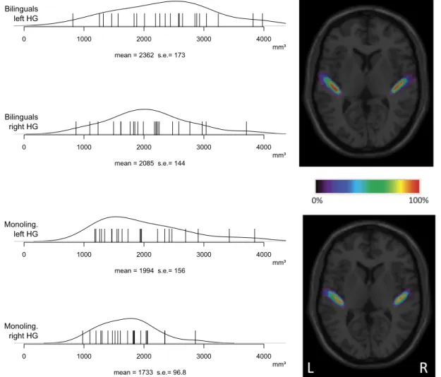Figure 1. Distributions of individual Heschl’s gyri volumes. Heschl’s gyrus volumes (in mm 3 ; normalized space) as a function of Side (left vs right hemisphere) and Group (monolingual vs bilingual)