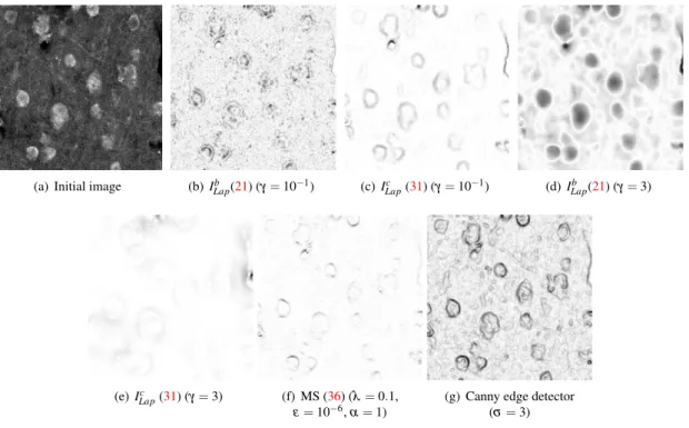 Figure 10: Comparison of (21) and (31) for different values of γ with the MS edge detection (36) and the Canny edge detector for a Poissonian real image containing rat’s neurons.