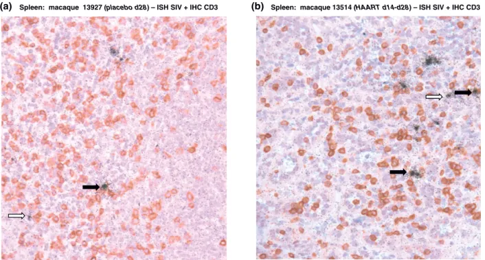 Figure 5 SIV-producing cells in the spleen of SIV-infected macaques receiving a short-term HAART just after the viremia peak