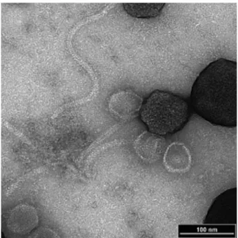 Figure  10.  Transmission  electron  micrograph  of  the  siphovirus  VB_SenS-AG11 4 
