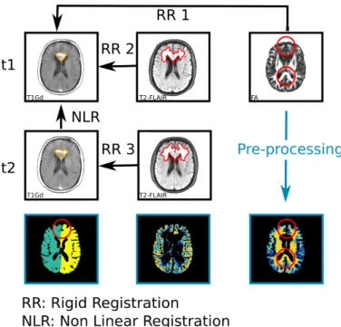 Figure 2: First row: Registration pipeline at time t 1 of the T1Gd, T2- T2-FLAIR, and FA