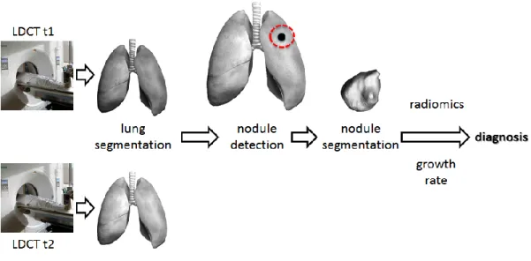 Figure  3.  Architecture  of  computer-aided  diagnosis  systems  for  lung  cancer  screening