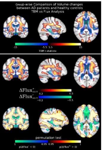 Figure 4: Cross-sectional comparison of the average volume changes in AD patients vs healthy controls