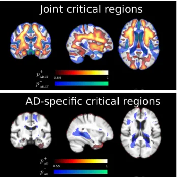 Figure 5: Group-wise comparison of critical regions. Top: probabilistic estimation of the criti- criti-cal regions of joint maximal expansion and contraction for AD and healthy subjects