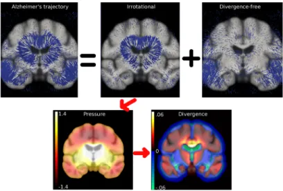 Figure 1: Helmholtz decomposition of the average longitudinal trajectory in AD, and pressure potential and divergence maps associated to the irrotational component