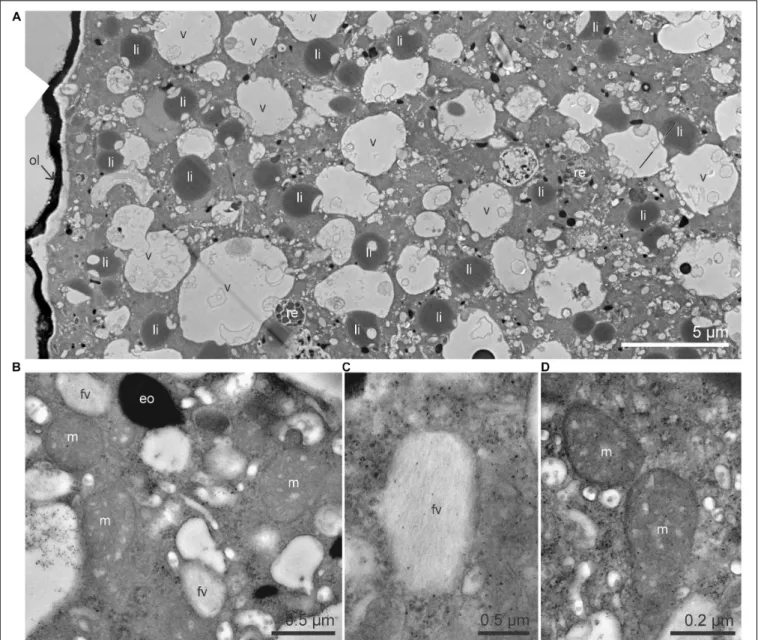 FIGURE 1 | TEM micrographs of the cytoplasm of Ammonia sp. (A) Global view of the cytoplasm with numerous lipid droplets, vacuoles and a few residual bodies.