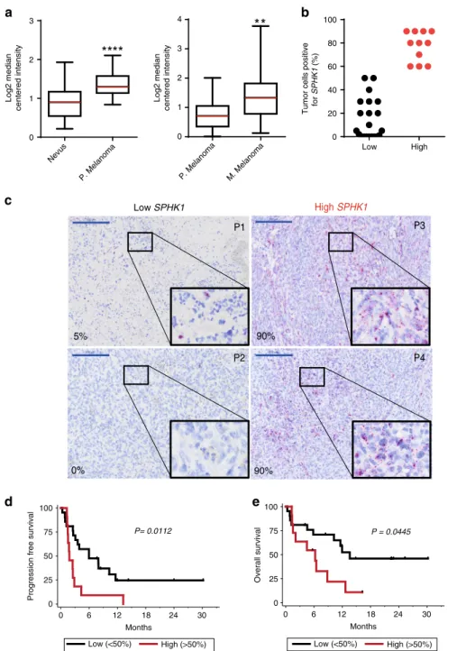 Fig. 1 SPHK1 expression inversely correlates with survival after ICI therapy. a SPHK1 expression in human nevi (n = 17) compared to primary (P) melanoma (n = 45), and in primary melanoma (n = 25) compared to metastatic (M) melanoma (n = 44) based on the On