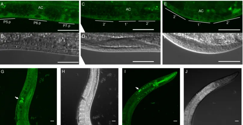 Fig 3. Ubiquitous expression of endogenous tagged RGL-1. A-F) We observed CRISPR-tagged endogenous RGL-1 throughout vulval lineages, located primarily in the cytosol (confocal: A, C, E; DIC: B, D, F)