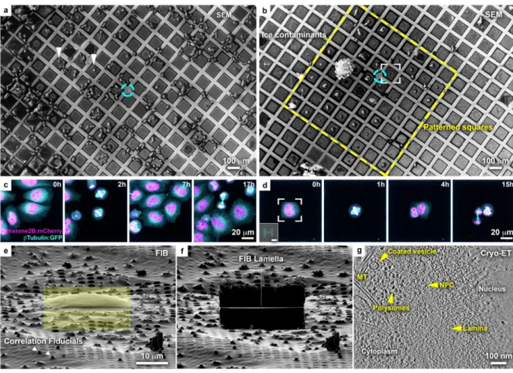 Figure 1. Micropatterning of cryo-EM grids refines preparation for cryo-FIB lamella  micromachining from adherent mammalian cells.