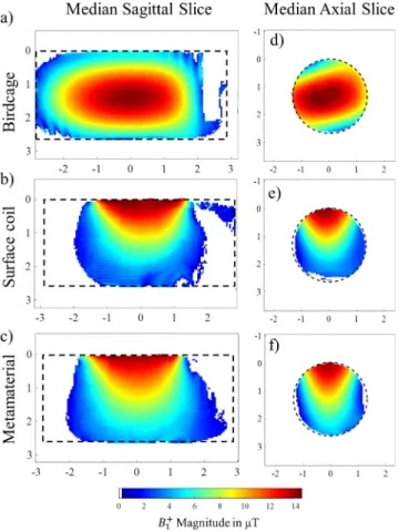 Fig. 3. Measured B þ 1 amplitude in the median sagittal slice with (a) the birdcage coil, (b) the surface coil alone and (c) the surface coil with the HMA