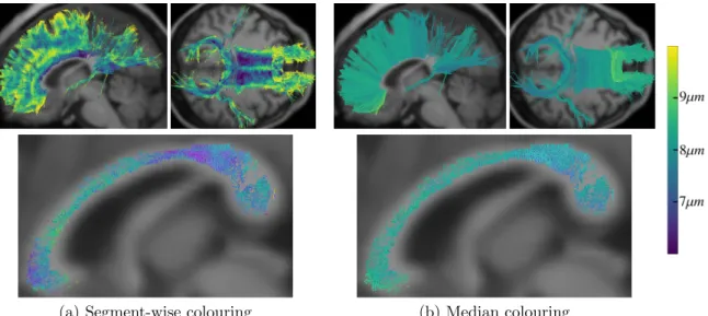 Figure 5: Axon diameter index α obtained with AxTract of the corpus callosum. (a,b) Streamlines coloured using α estimated per segment and the whole-streamline median α, respectively