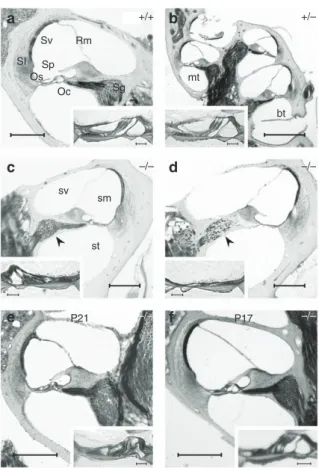 Figure 3 | Localization of KCNK5 expression in adult mice. In a Kcnk5  / mouse cochlea in toto (a) X-gal staining (blue) forms two parallel spiral lines (arrowhead) under the blue spotted-stained (asterisk) stria vascularis (Sv)