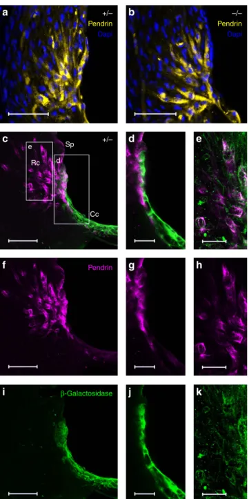 Figure 4 | Immunodetection of pendrin and/or b-galactosidase. In cryostat sections from adult cochleas, pendrin (yellow) appears in spiral prominence (Sp) and root cells (Rc) with a similar pattern of expression in Kcnk5 þ / (a) and Kcnk5  /  (b) mice at P