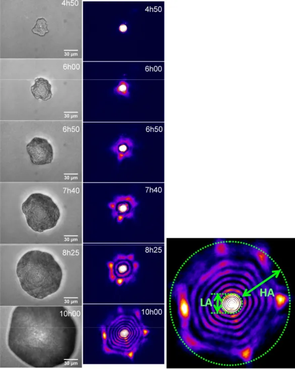 Figure 2: Kinetic study on a given  E. coli microcolony (EC28), between 4h50 and 10h00 of  incubation on TSA agar medium at 37°C