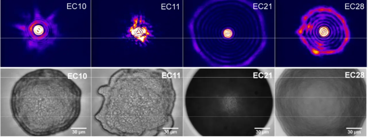 Figure  4:  Typical  scatterograms  (upper  row,  reciprocal  space)  and  corresponding  images  (lower row, direct space; scale bars stand for 30 µm) for the four strains of E