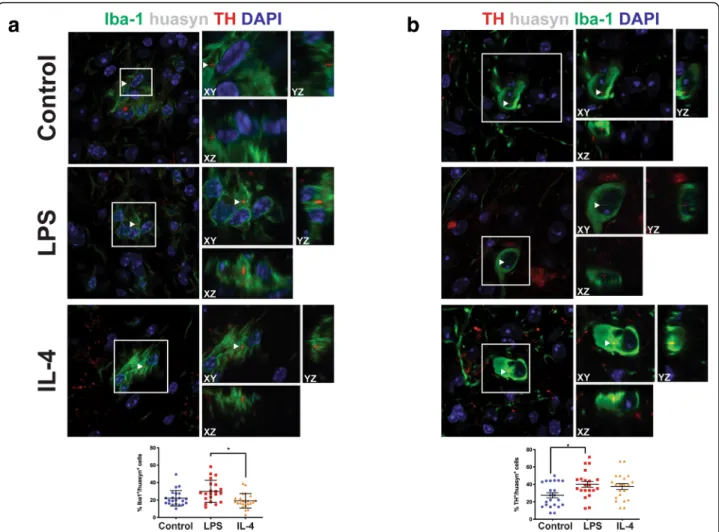 Fig. 6 Increased hu α -syn in the striatum of LPS-injected mice. a Western blots of striatal samples probed for hu α -syn, pS129 α -syn, LC3B-1, LAMP1 and p62 in control, LPS-injected, and IL-4-injected mice