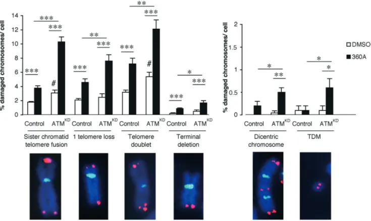 Figure 2. 360A induces speciﬁc telomere aberrations in HeLa cells that are increased in ATM knocked down cells