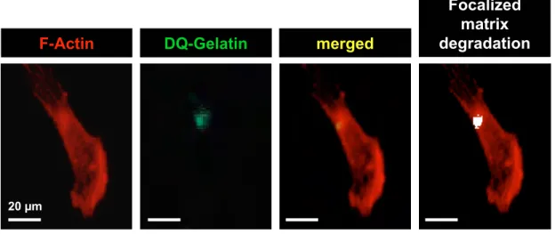 Fig. S4: A, The invadopodial activity in MDA-MB-231 cancer cells cultured on a Matrigel™-composed matrix containing DQ- DQ-Gelatin® was assessed and defined as being F-actin foci (red labelling, phalloidin-Alexa594) co-localised with focused proteolytic  a