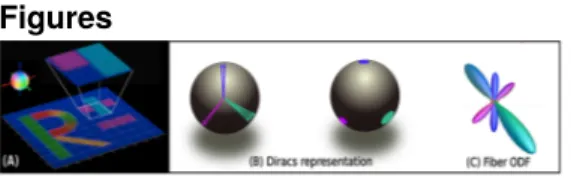 Figure 1: Analytical ﬁber ODF reconstruction: (A) from   , super-voxel deﬁnition from high-resolution tissue ﬁber orientation map, (B) each orientation modeled as Diracs and ﬁber ODF as weighted sum of these Diracs on the unit sphere, and (C) SH expansion 
