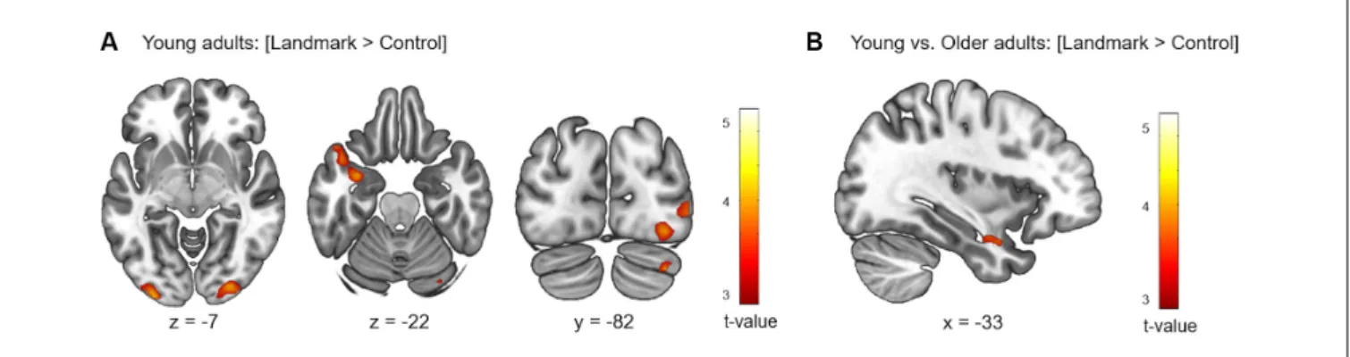 FIGURE 4 | Cerebral regions whose activity for the contrast [Landmark &gt; Control] was elicited by within- (A) or between-group (B) analyses projected onto 2D slices (p &lt; 0.001 uncorrected, k = 10 voxels).