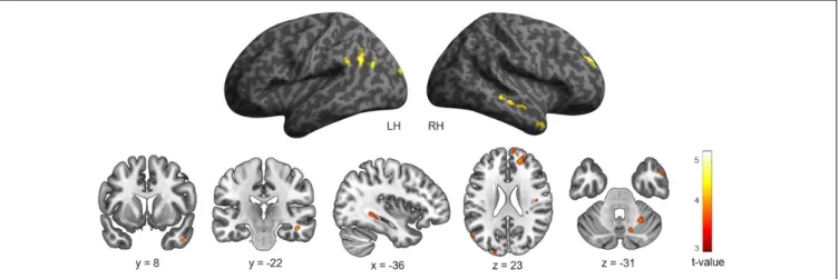 FIGURE 3 | Cerebral regions whose activity for the contrast [Landmark &gt; Control] was predicted by navigation time projected onto 3D inflated anatomical templates and 2D slices (p &lt; 0.001 uncorrected, k = 10 voxels)