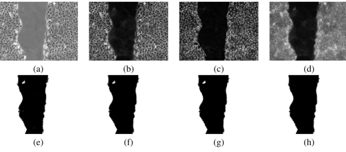 Figure 2: The different steps of the image processing pipeline. The upper left image is an original section, while the lower right one is the binarized wound front