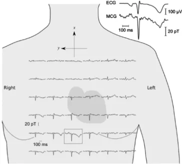 FIG. 2. 共 Color online 兲 The experimental setup 共 ECG not shown here 兲 .