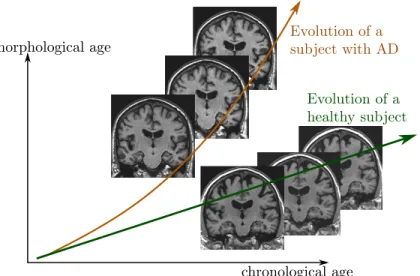Figure 1: Schematic representation of two evolutions relative to an hypothetical morphological age reflecting the structural status of the brain relative to the aging process.