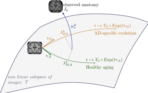 Figure 2: Our two-trajectory model. The template image T 0 , the normal aging template trajectory parametrized by v A and the disease specific template trajectory parametrized by v D define a subspace of possible morphologies of reference