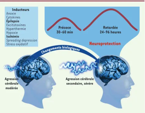 Figure 1. Critères définissant les concepts du préconditionnement et de la tolérance cérébrale